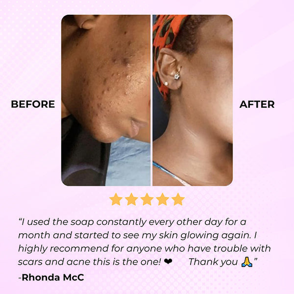 Turmeric Glow Miracle Soap