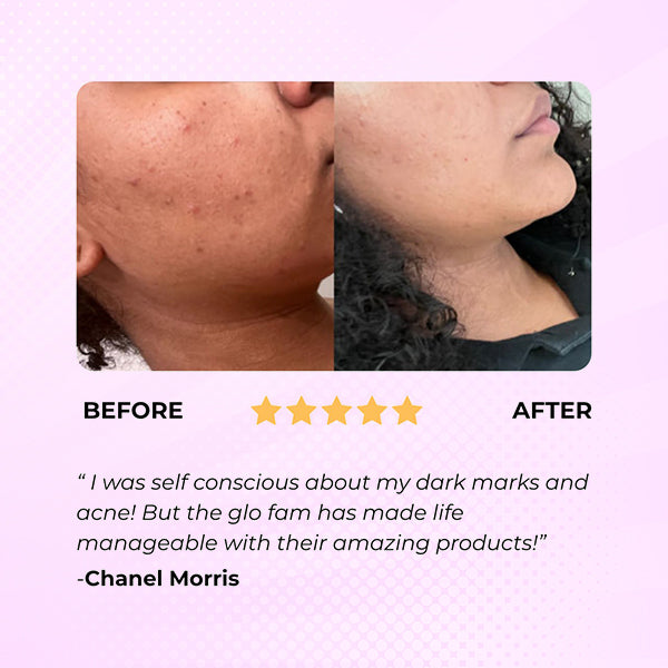 Turmeric Glow Miracle Soap