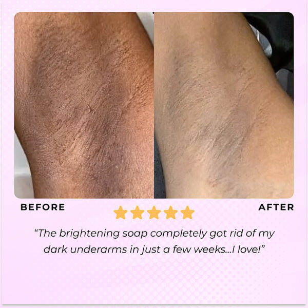 Turmeric Glow Miracle Soap